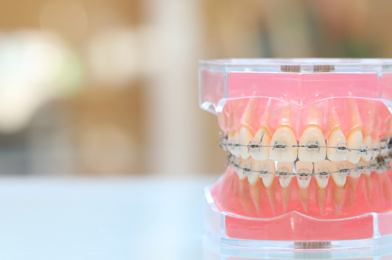 歯並びが気になりませんか？