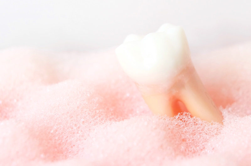 歯周病とはどんな病気？