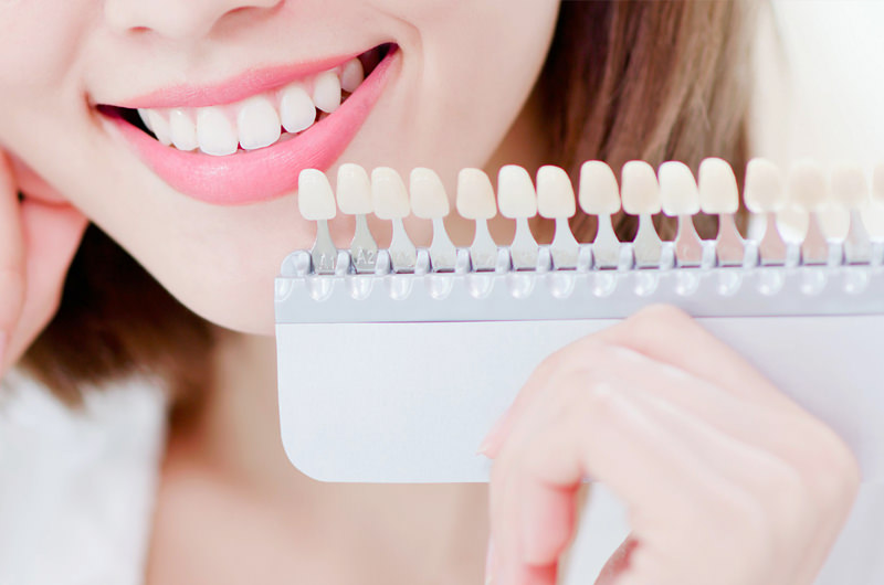 歯の変色・黄ばみが気になる時は？