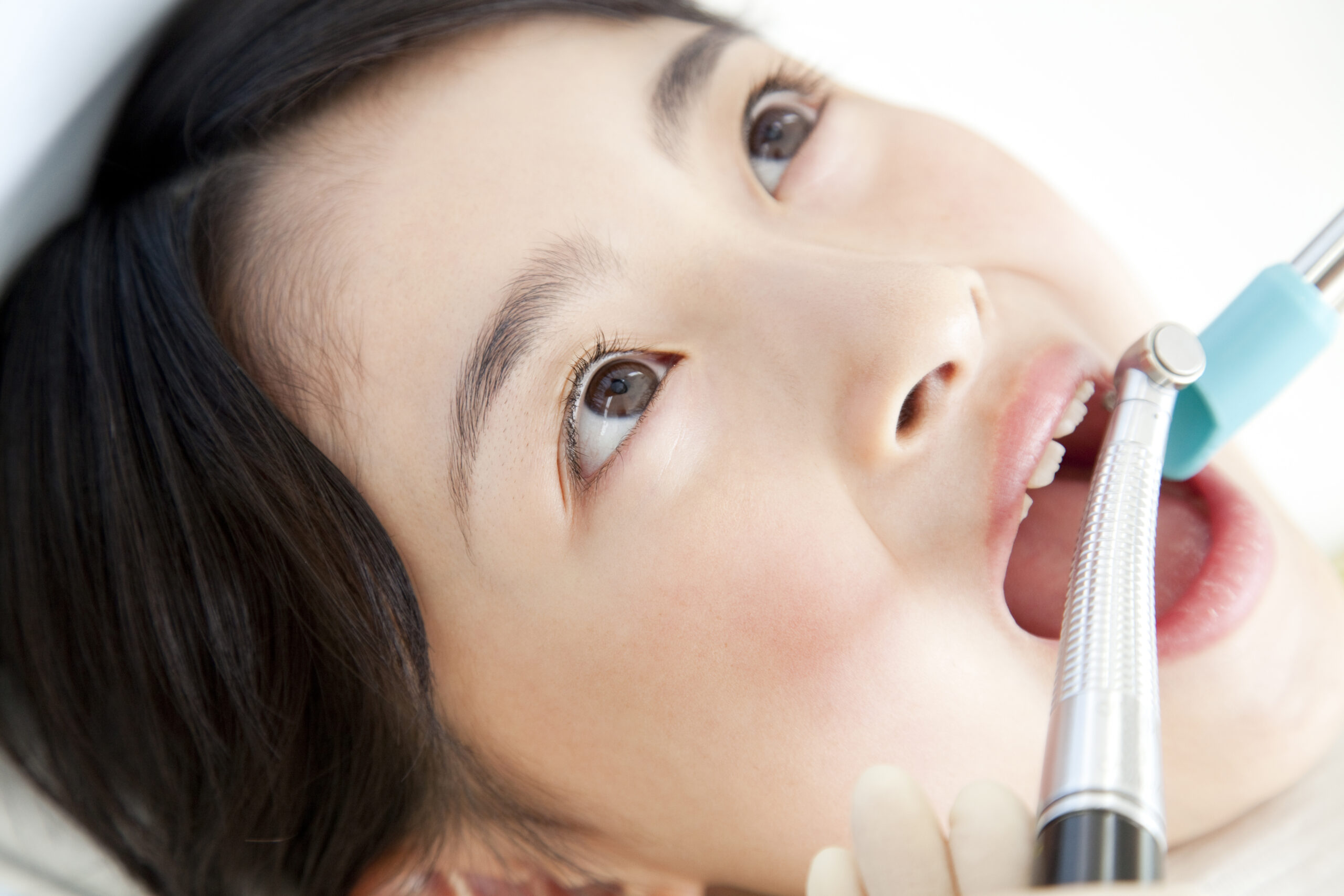 虫歯の再発に要注意！再治療しなければならない理由とは？